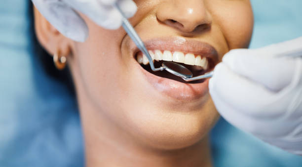 Best Lost Filling or Crown Replacement in Fort Recovery, OH