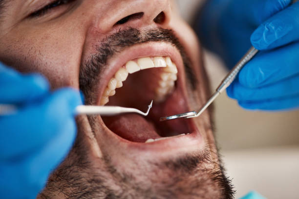 Best Emergency Care for Gum Disease in Fort Recovery, OH