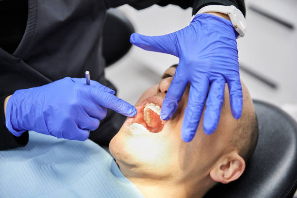 Best Emergency Dental Care for Sports Injuries in Fort Recovery, OH